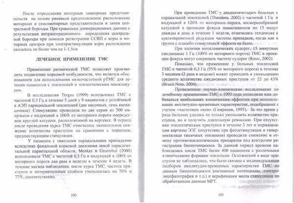 Сотая страница книги Эпилепсия и стимуляция мозга